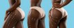 Can You Get a Brazilian Butt Lift Surgery with a Tummy Tuck? Can You Get a Brazilian Butt Lift Surgery with a Tummy Tuck?