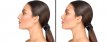 What Causes a Droopy Nose?