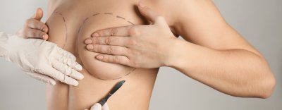 Benefits of Breast Reconstruction After Fighting Cancer Benefits of Breast Reconstruction After Fighting Cancer