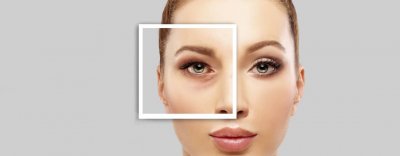 Who is an Ideal Candidate for Lower Blepharoplasty Surgery? Who is an Ideal Candidate for Lower Blepharoplasty Surgery?